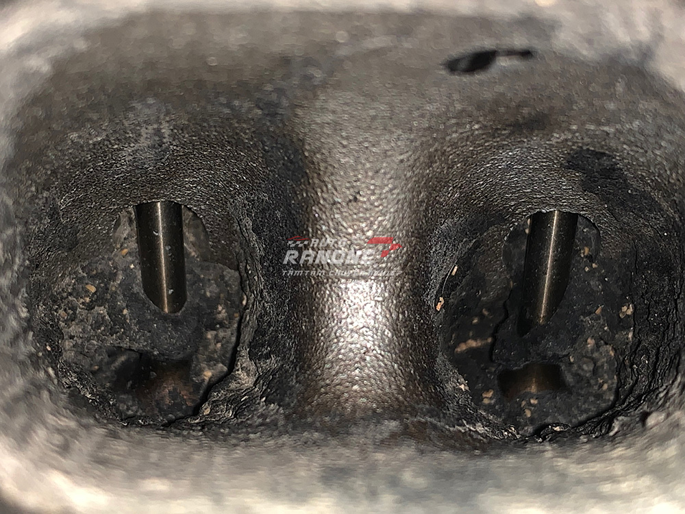 vệ sinh họng nạp