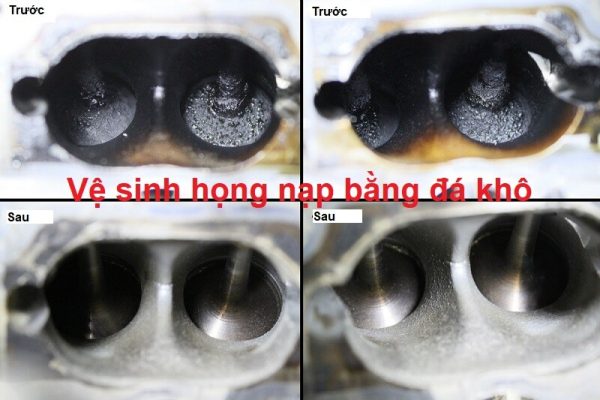 vệ sinh họng nạp